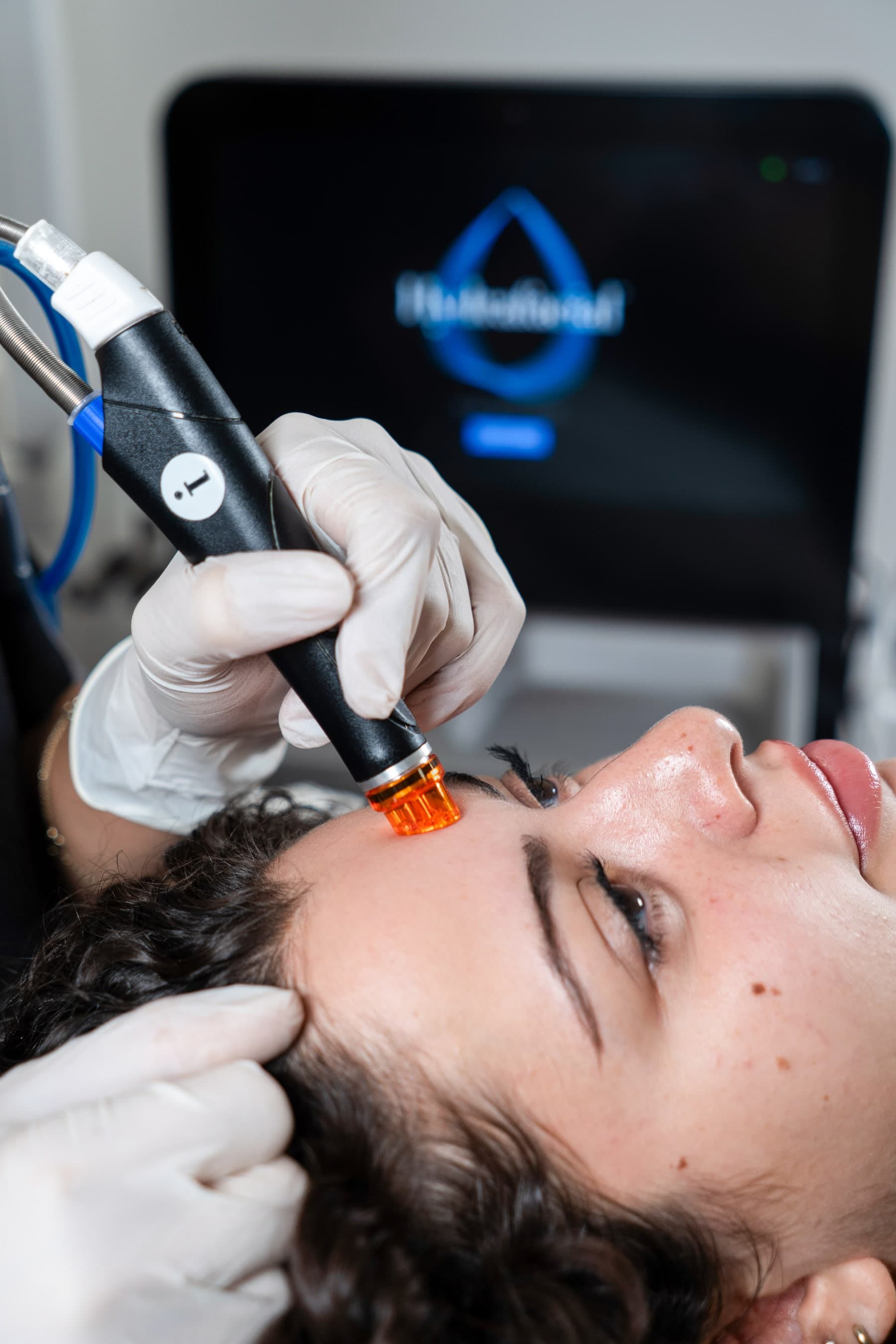 HydraFacial Syndeo başlığı, arka planda cihaz