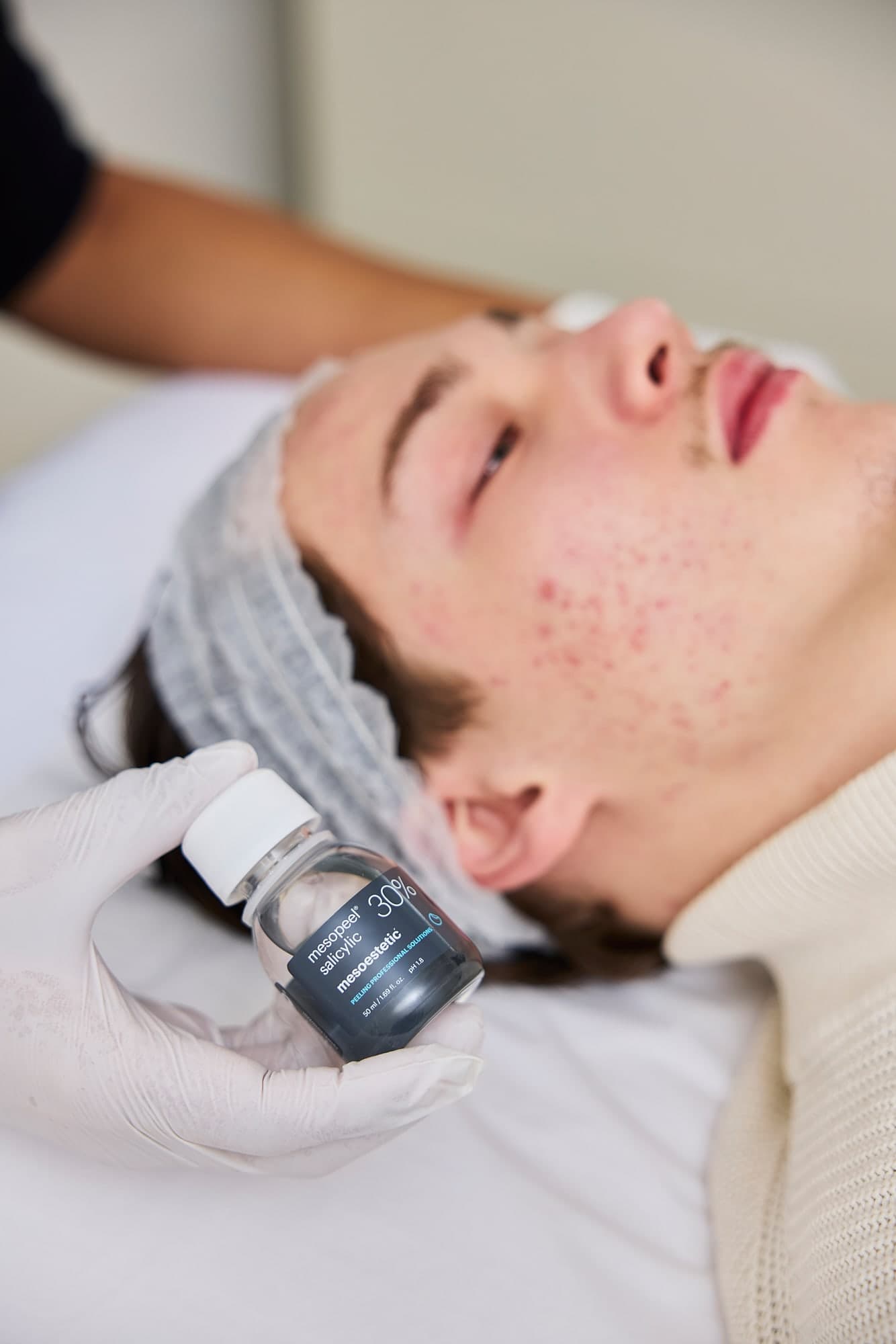 Een behandelaar houdt een klein flesje vast naast het gezicht van een cliënt met acne op de behandelstoel